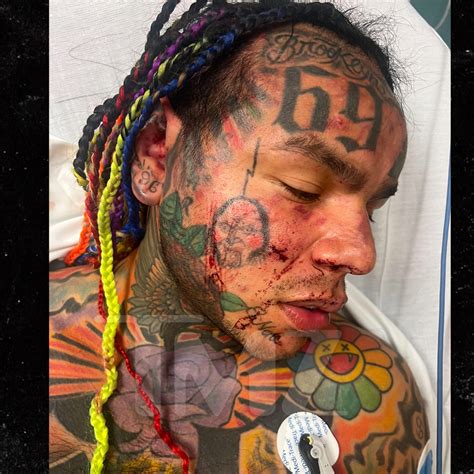 Photo Illustration by The Daily Beast. Tekashi 6ix9ine’s ex-girlfriend said the first beating at the hotel in Dubai came shortly after she arrived from New York. “He punches me out of nowhere ...
